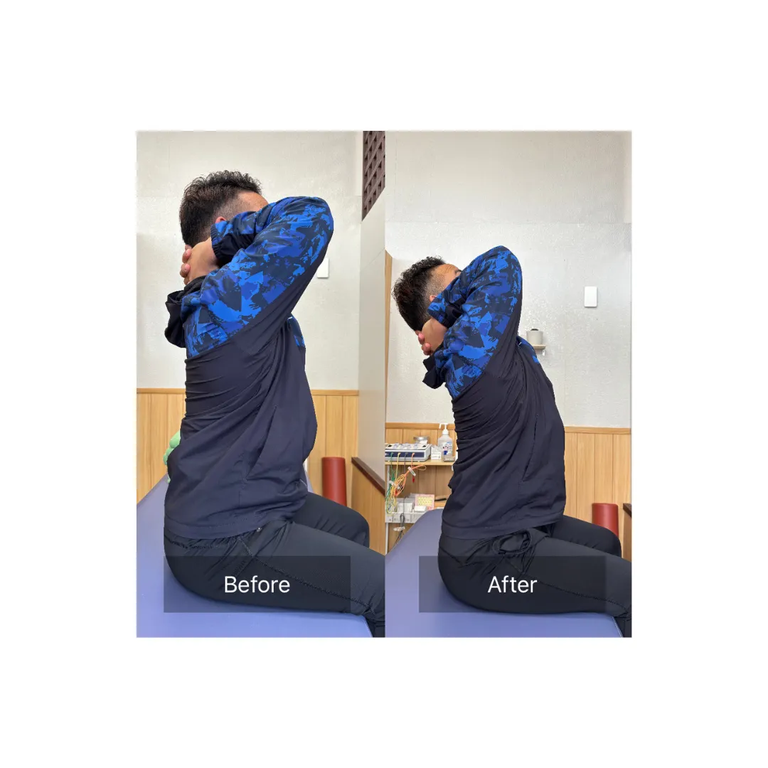 30代 背中のこり・張り