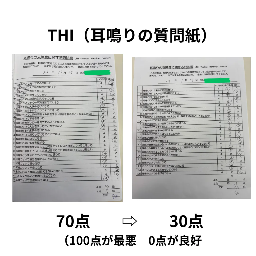 耳鳴りの苦痛度アンケート