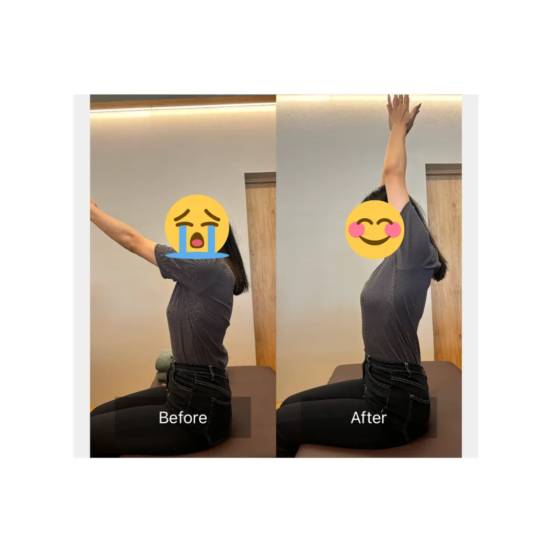 デスクワークによる首肩の凝り