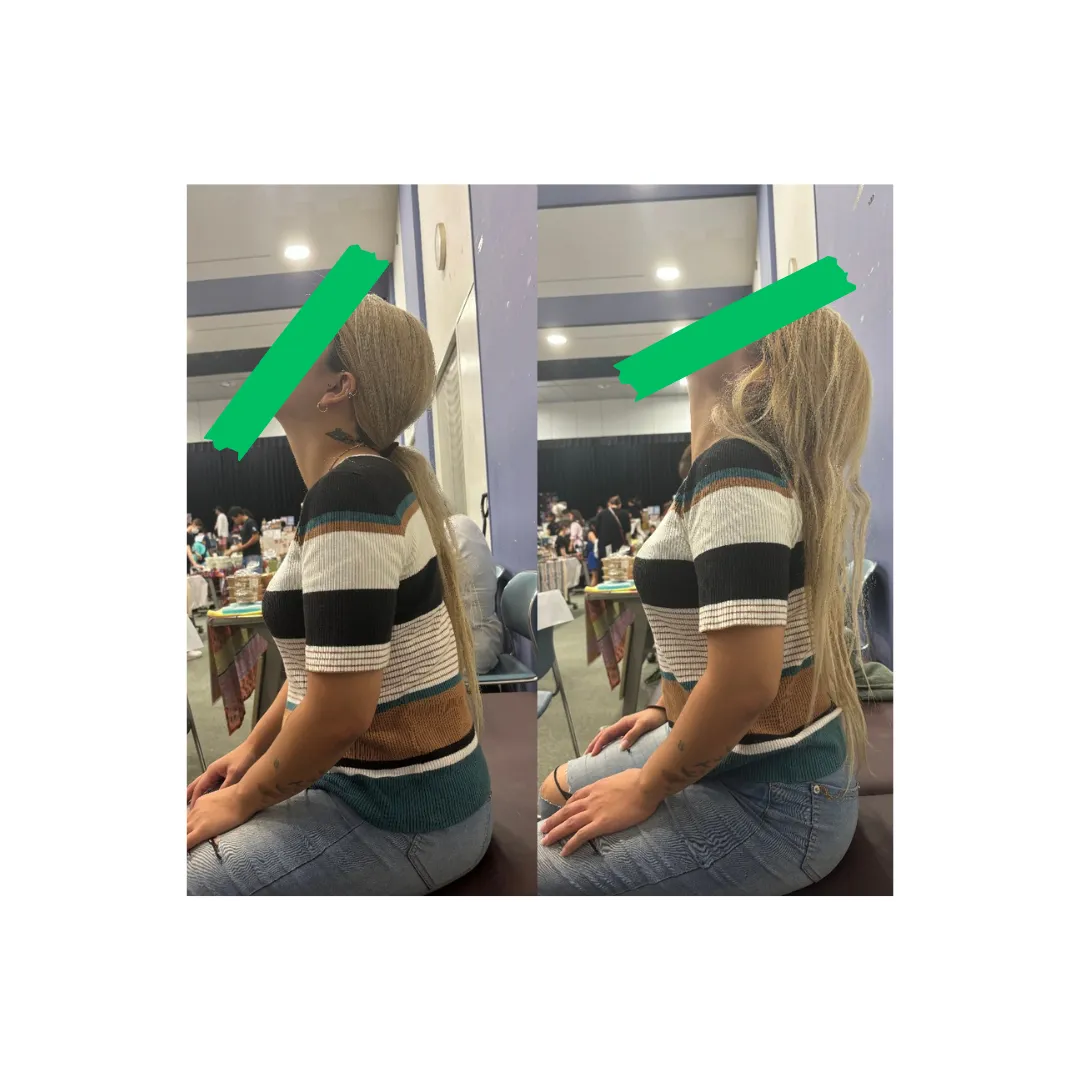 首肩の凝りと痛み